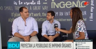 Entrevista en Buen Día Uruguay Planificación de cirugías gracias a modelos 3D